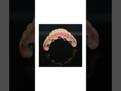 FDA PFM Crown Porcelain fused to Metal Crown