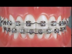 Removable Dental Partial Denture Natural Color 3D Dental Model Customized