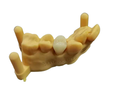 Soem 3D, das Digital-Entwurf Labor des flexiblen Acrylgebisses zahnmedizinischen druckt