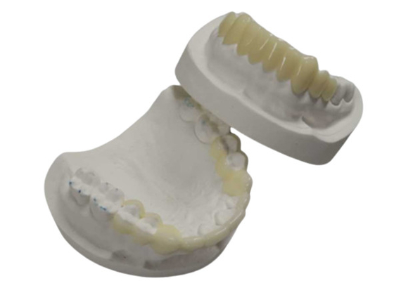 Hohe Haltbarkeit CAD CAM 3D-Druck Temporäre Kronen Langlebiges Harz