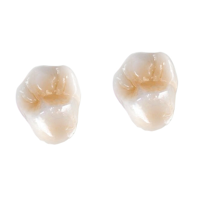 Zirkoniumdioxid-zahnmedizinischer Kronen-Furnier-Blatteinlegearbeit Onlay Vollkeramik FDAs 3014652903