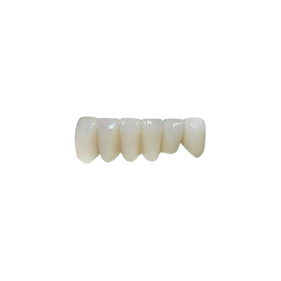 OEM Implantat Zirkonia Zahnkrone Festbrücke