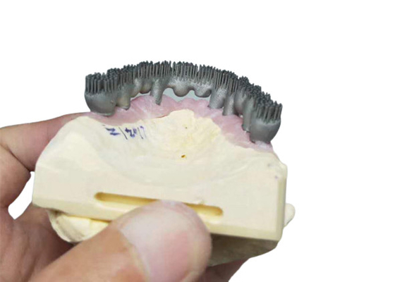 Dauerhafter Drucker Dental Lab Prints CAD-Nockens PFM 3D für Forschung