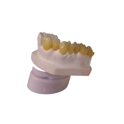 DES CAD-Nocken-Entwurfs-PFM zahnmedizinischer Drucker Dental Crowns Kronen-Labor3d