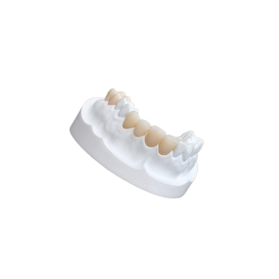 Porzellan-zusammengesetzte Furnier-Blätter IPS E Max Ceramic Dental Crown Comfortable