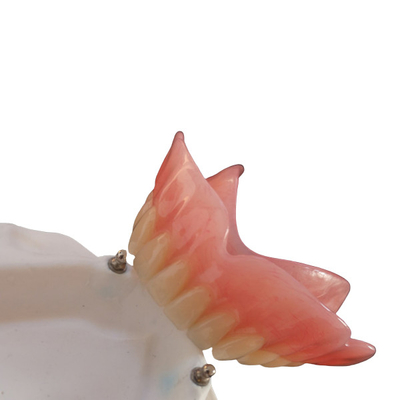 Hohes Implantat des Biocompatibility-Präzisions-Zubehör-Gebiss-CAD-CAM