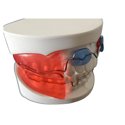 Die zahnmedizinischen orthodontischen einfachen Geräte installieren Hightech- biologisches Material