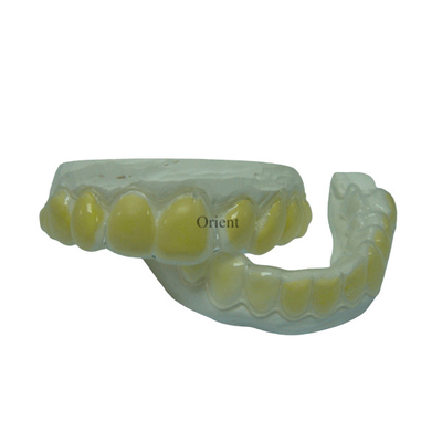Orthodontische Geräte FDAs sind korrosionsbeständig und dauerhaft
