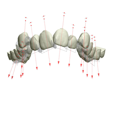 Gutes Biocompatibility reparierte orthodontische Gerätegummihalter