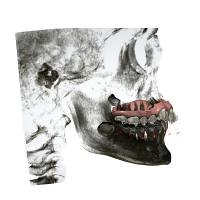 Die kundengebundenen örtlich festgelegten orthodontischen einfachen Gummigeräte halten instand
