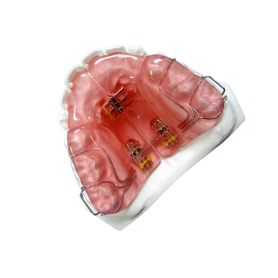 Hohes Härte FDA-Funktionsgeräteorthodontischer Gummihalter