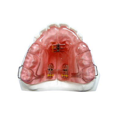 Kundenspezifisches entfernbares Soem regelte orthodontisches Gerätegute Haltbarkeit