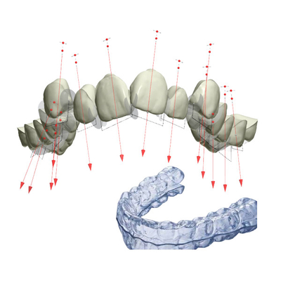 Halter stützt FDA reparierte orthodontisches Gerät mit 3D ab