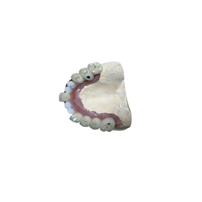 Genaue Zahnimplantat-Zubehör-Zahn-Implantats-Krone Biocompatibility