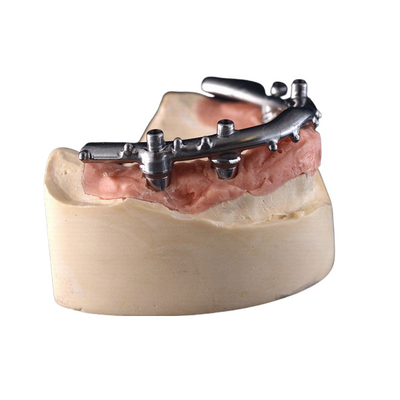 Sicherte Titan-Implantat CNC-All-On-4 Gebisse für zahnmedizinische Klinik