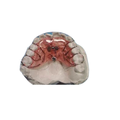 Sichere örtlich festgelegte Ausrichtungstransport-einfache entfernbare örtlich festgelegte orthodontische Reinigungsklammern