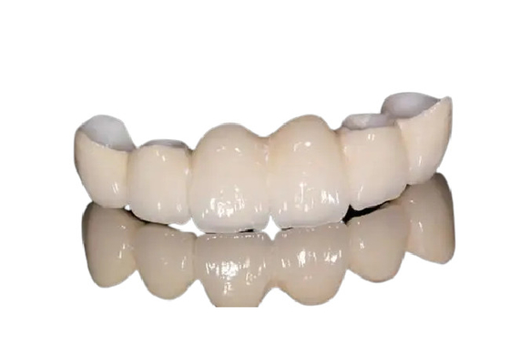 Korrosionsbeständige Porzellan-zahnmedizinische Kronen-natürlicher Auftritt für Front Teeth/Backenzähne