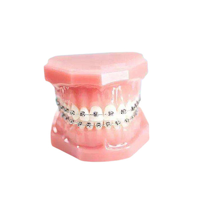 Glatte orthodontische Metalloberflächenklammer-dauerhaftes örtlich festgelegtes Gerät