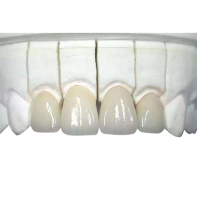 3D druckte Zirkoniumdioxid-zahnmedizinische Krone haltbares in hohem Grade Biocompatible