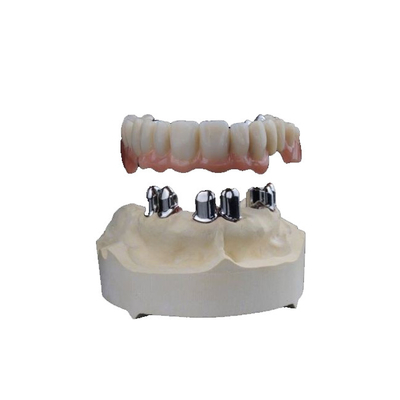Zahnmedizinisches 3D druckte Zirkoniumdioxid krönt haltbares hohes Biocompatibility