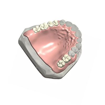 Zahnmedizinisches Modell Customized der entfernbare zahnmedizinische Teilprothese-natürliches Farbe3d
