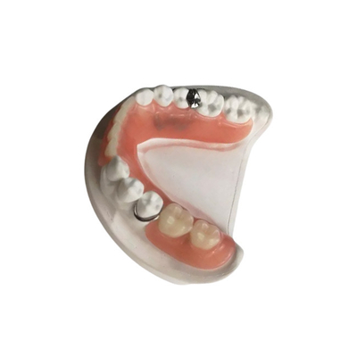 3D druckte Zirkoniumdioxid-zahnmedizinische Kronen-Qualitätssicherungs-entfernbare Gebisse nach Maß