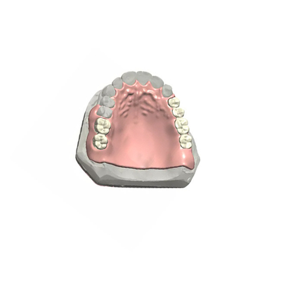 Realistische Kronen-Qualitätssicherung 3D des Auftritt-PFM zahnmedizinische druckte zahnmedizinische Modelle