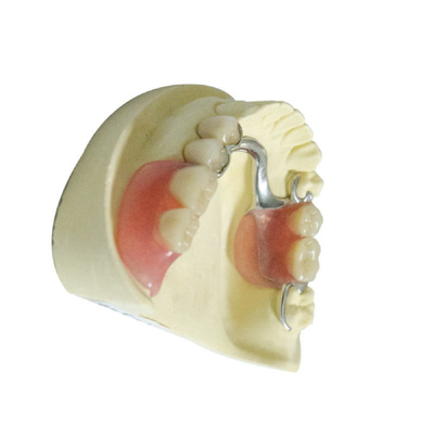 Professionelle zahnmedizinische Laborprodukt-entfernbare acrylsauerTeilprothesen