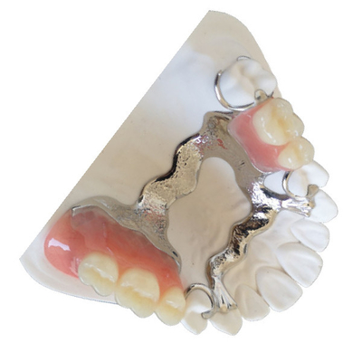 Kundengebundene PFM-Zahn-Krone 3D, die PFM-Zahnbrücke druckt