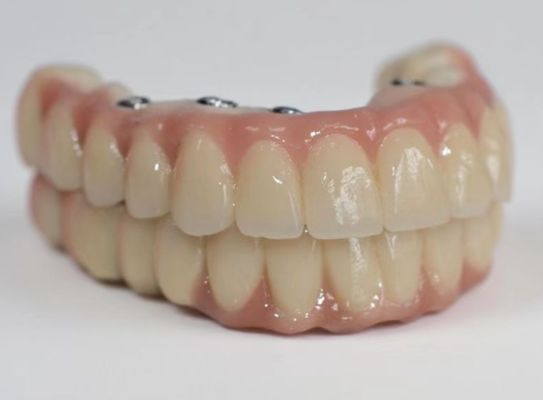 CAD CAM Zirkonoxid Dental All On