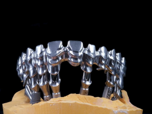 FDA 3014652903 PFM-Brücke zahnmedizinische in hohem Grade ästhetische extrem starke