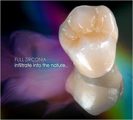 Zirkoniumdioxid-zahnmedizinischer Kronen-Furnier-Blatteinlegearbeit Onlay Vollkeramik FDAs 3014652903