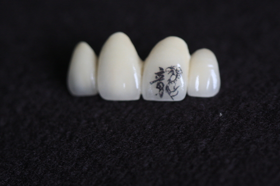PFM Dental Crown Image Anpassung mit personalisierten individuellen Mustern