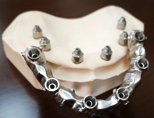 FDA 3014652903 PFM-Brücke zahnmedizinische in hohem Grade ästhetische extrem starke