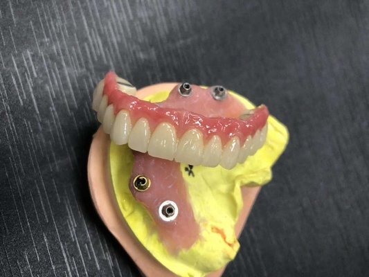 FDA 3014652903 PFM-Brücke zahnmedizinische in hohem Grade ästhetische extrem starke
