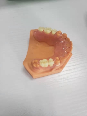 3D druckte Gebisse für die zahnmedizinischen Labors, die auf Digital-Daten basierten