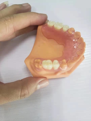 3D druckte Gebisse für die zahnmedizinischen Labors, die auf Digital-Daten basierten