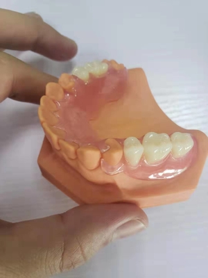 3D druckte Gebisse für die zahnmedizinischen Labors, die auf Digital-Daten basierten