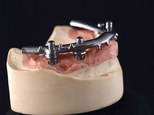 Sicherte Titan-Implantat CNC-All-On-4 Gebisse für zahnmedizinische Klinik