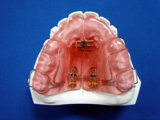 Hohes Härte FDA-Funktionsgeräteorthodontischer Gummihalter