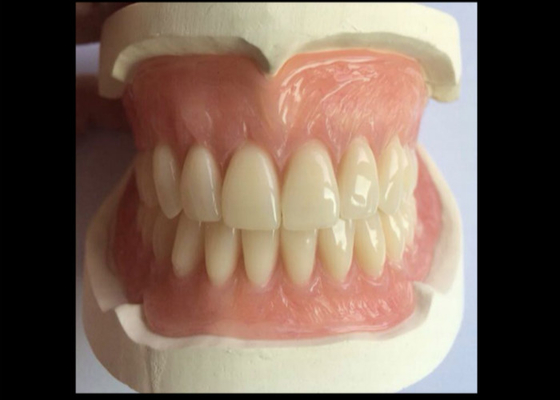 CAD-CAM, die Gummi-3D Kronen druckte, sind einfach instandzuhalten und zu passen