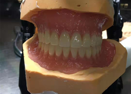 CAD-CAM, die Gummi-3D Kronen druckte, sind einfach instandzuhalten und zu passen