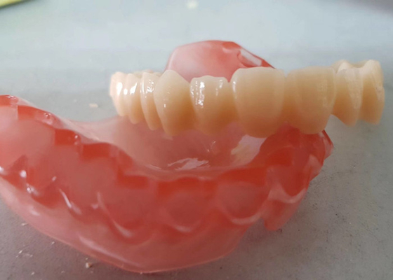Realistisches Digital-Daten Soem 3D druckte zahnmedizinische Modelle für Zahnarzt Study