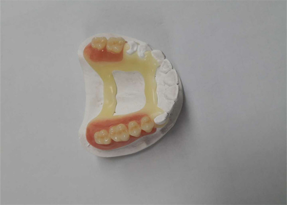 Gummi-PFM zahnmedizinischer Drucker Dental Laboratory des natürlichen Blick-der Kronen-3D