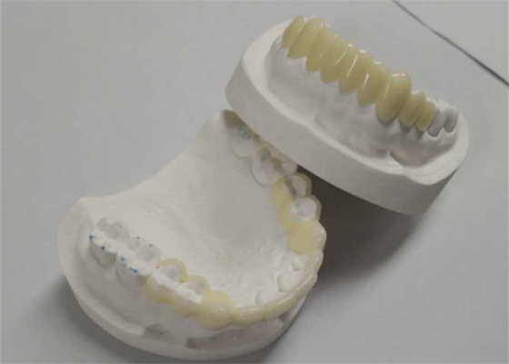 Hohe Haltbarkeit CAD CAM 3D-Druck Temporäre Kronen Langlebiges Harz
