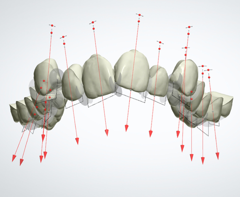 Gutes Biocompatibility reparierte orthodontische Gerätegummihalter