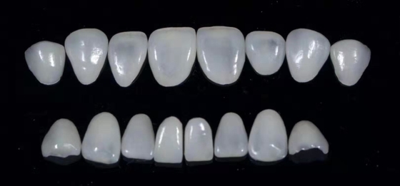 Zahnmedizinische zusammengesetzte Furnier-Blätter Durablity CAD-CAM führten in hohem Grade genaues einzeln auf
