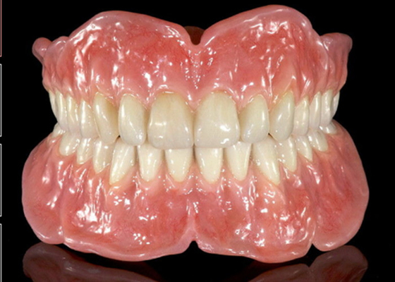 Die flexible entfernbare zahnmedizinische einfache Kronen-GummiTeilprothese halten instand