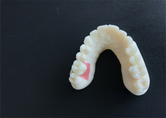 CAD-Nocken-Entwurfs-Gebiss-zahnmedizinisches Labor Modell 3D Digital
