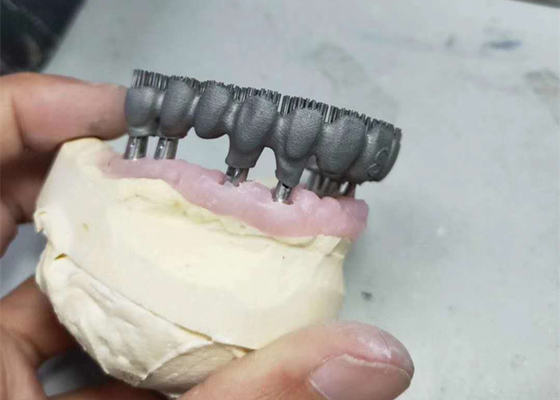 Dauerhafter Drucker Dental Lab Prints CAD-Nockens PFM 3D für Forschung